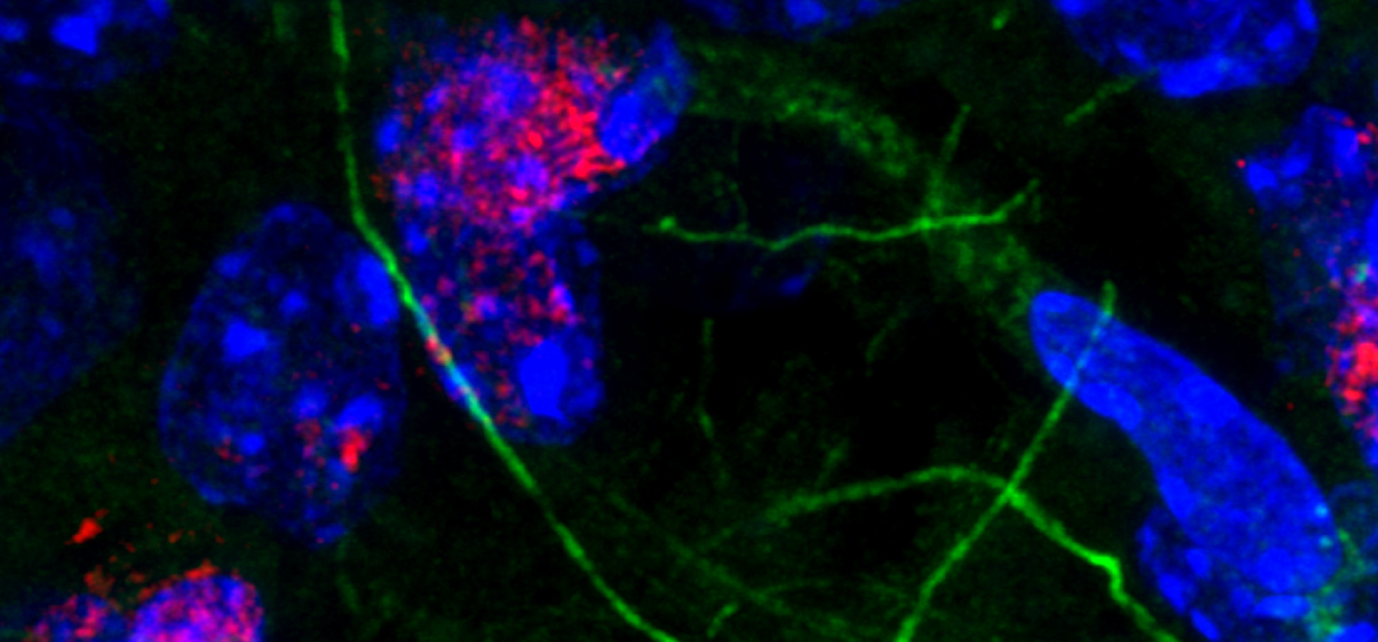 Immunofluorescent staining of mouse brain, showing neurons and glial cells in the hippocampus. Blue are cell nuclei, while green are microfilaments of the cell extensions. Red is a marker of DNA damage and is predominantly in the neurons.