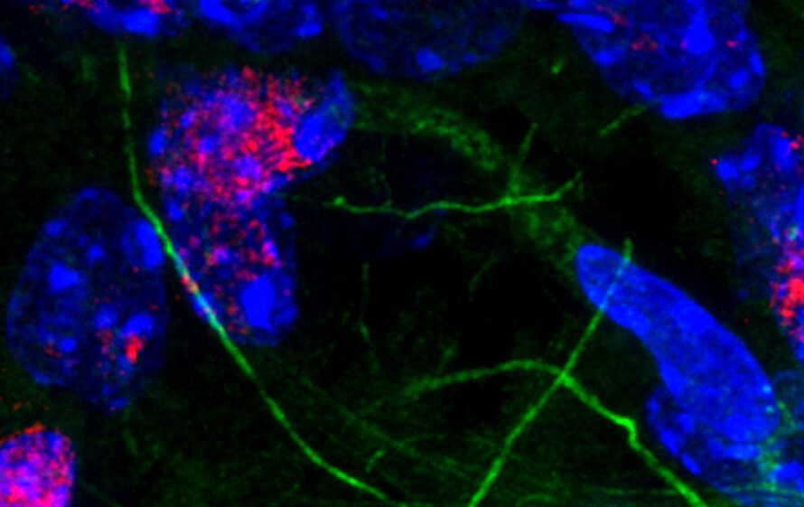 Immunofluorescent staining of mouse brain, showing neurons and glial cells in the hippocampus. Blue are cell nuclei, while green are microfilaments of the cell extensions. Red is a marker of DNA damage and is predominantly in the neurons.